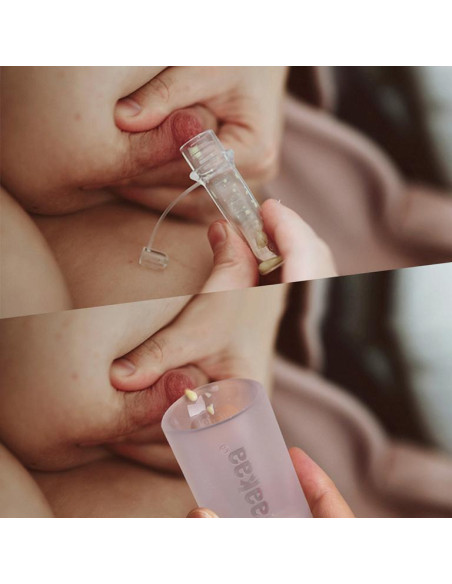 Silicone Colostrum Collector (Medical-grade & Pre-sterilised)